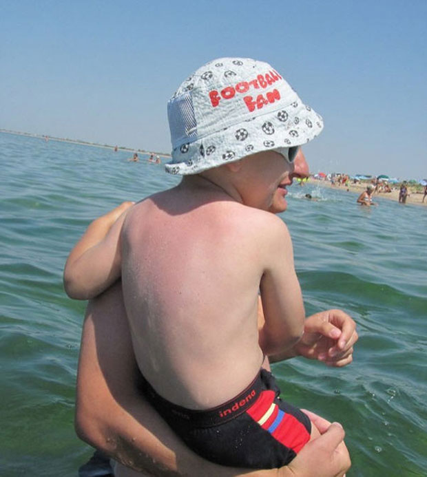 This baby does not has head of a man