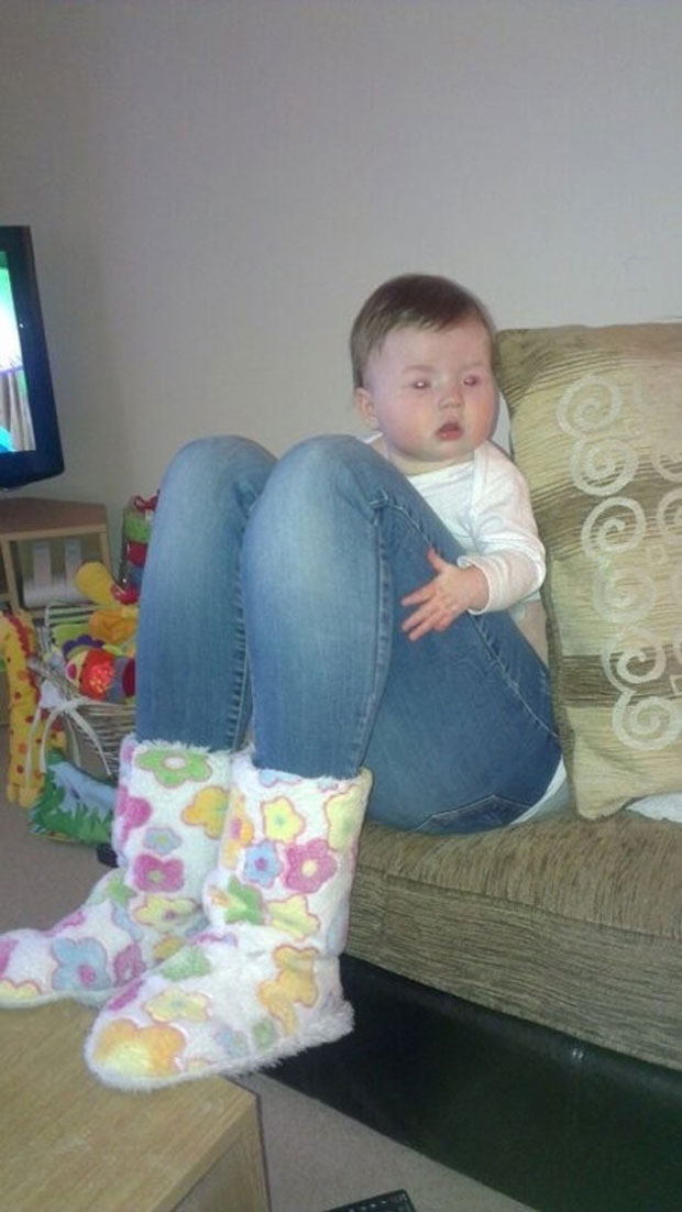This baby does not has huge legs