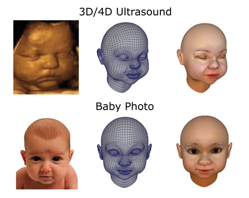 3D Printing Enables You To Hold Your Baby In Arms Even Before Its Birth-
