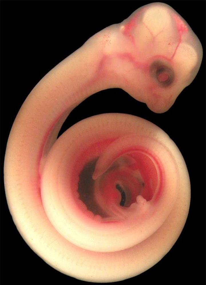 The snake-Awesome Photographs Of Baby Animal Fetuses In The Womb-