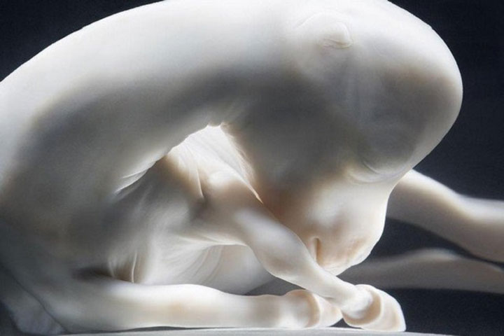 The horse-Awesome Photographs Of Baby Animal Fetuses In The Womb-10