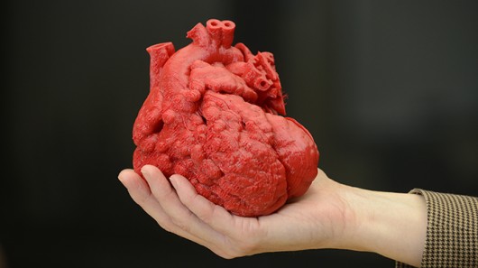 Doctors Use 3D-Printed Heart Model To Perform A Life-Saving Surgery (Video)-