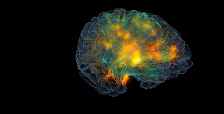3D modeling of human brain activity-