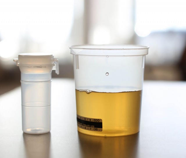 Future Robots Could Be Powered By Your Own Urine-