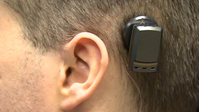 billy ear implant