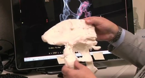 it can make other shapes as well
