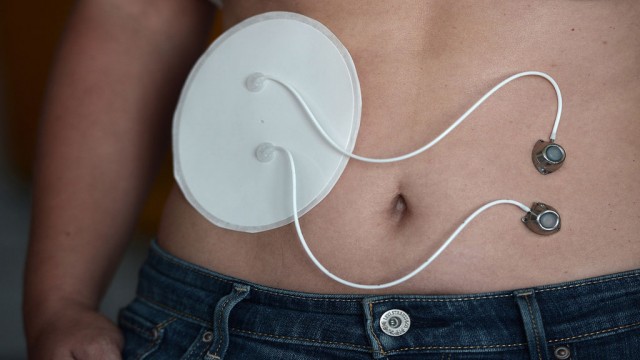 Bioartificial Pancreas Will Revolutionize The Daily Life Of Diabetics-2