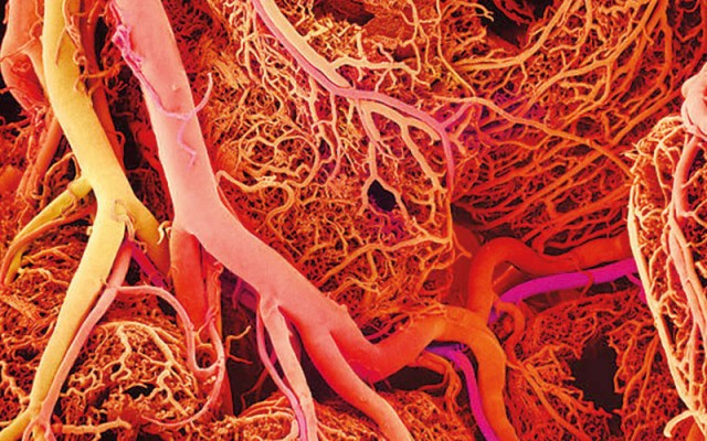 A Giant Step For Artificial Organs: Blood Vessels Synthesized By 3D Printing-6