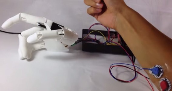 A Bionic Hand At Dirt Cheap Price Thanks To 3D printing-1