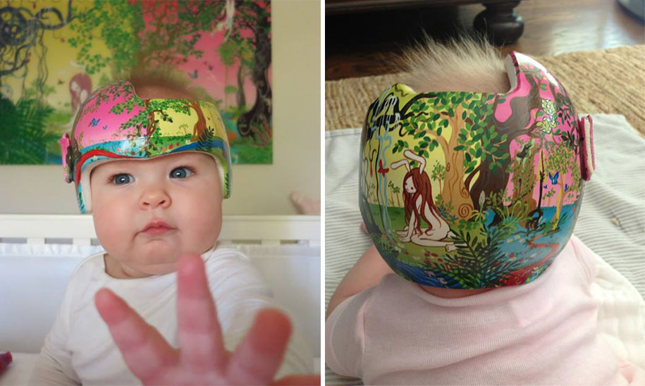 Artist Brings Smiles To Babies By Transforming Their medical Helmets Into Artworks-1