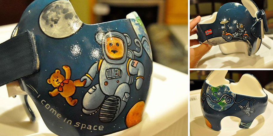 Artist Brings Smiles To Babies By Transforming Their medical Helmets Into Artworks-2