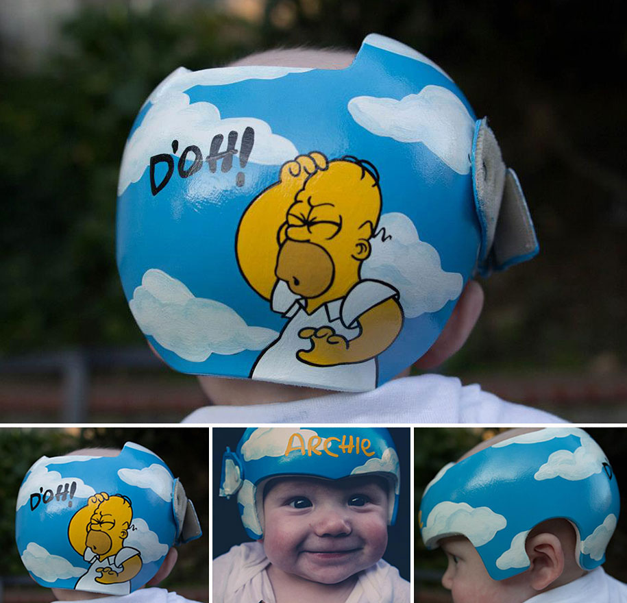Artist Brings Smiles To Babies By Transforming Their medical Helmets Into Artworks-3