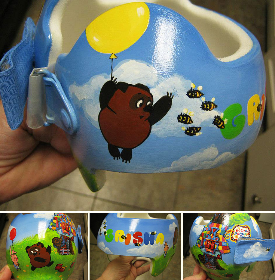 Artist Brings Smiles To Babies By Transforming Their medical Helmets Into Artworks-7