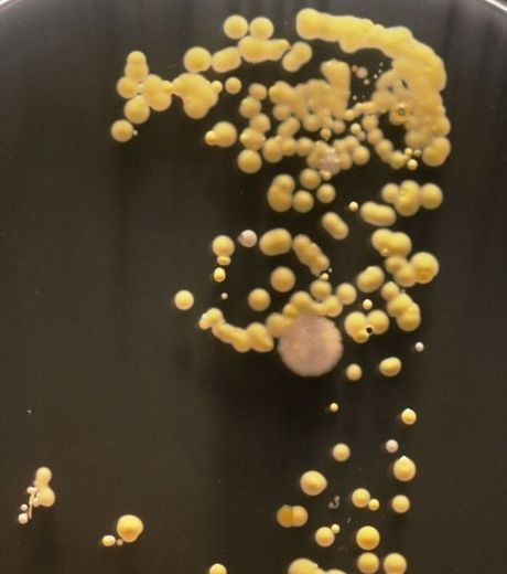The Dangerous Bacteria On Your Smartphone (gallery)