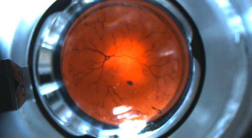 Nano-Scopic Robots Will Soon Perform Eye Surgery (Video)
