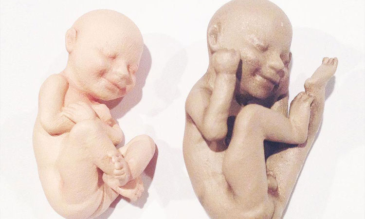 3D Printing Enables You To Hold Your Baby In Arms Even Before Its Birth-1