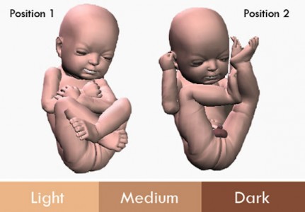 3D Printing Enables You To Hold Your Baby In Arms Even Before Its Birth-2
