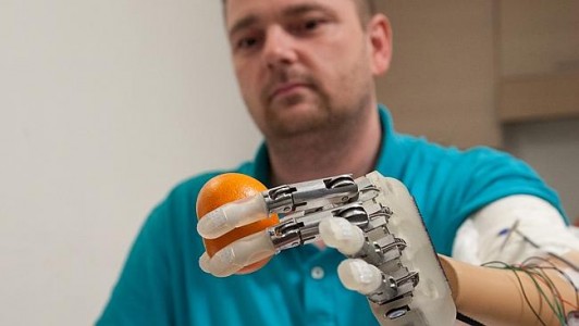 Scientists Develop A Bionic Hand With A Feeling Of Touch-