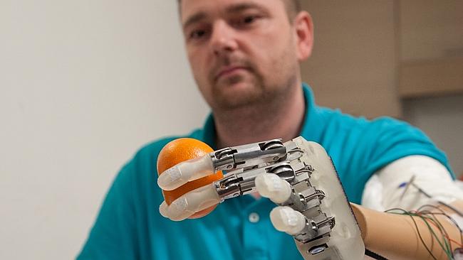 Scientists Develop A Bionic Hand With A Feeling Of Touch (Video)