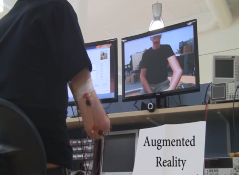 Phantom Limb Pain Relief Using Augmented Reality Techniques (Video)