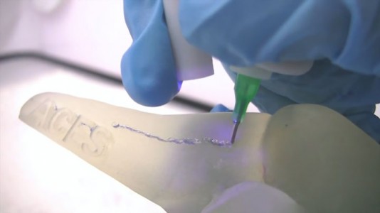 Scientists Invent A Revolutionary Biopen To Easily Repair Bone Fractures-4