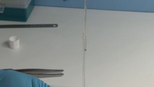 A Super Glue That Quickly Connects Human Tissue Will Revolutionize Surgery (Video)-1