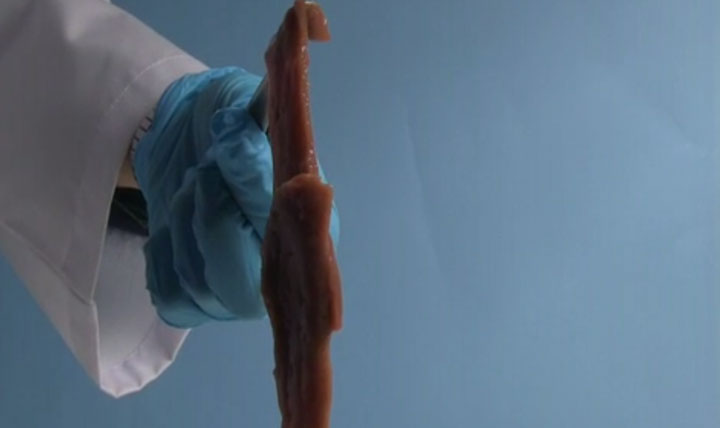 A Super Glue That Quickly Connects Human Tissue Will Revolutionize Surgery (Video)