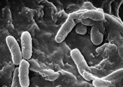 Scientists Have Discovered A Bacteria Species Thats Feeds Upon Electricity-1