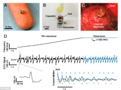 Wirelessly charging Heart pacemaker | TechnoCrazed