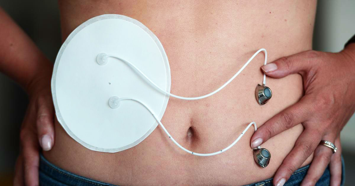 Bioartificial Pancreas Will Revolutionize The Daily Life Of Diabetics