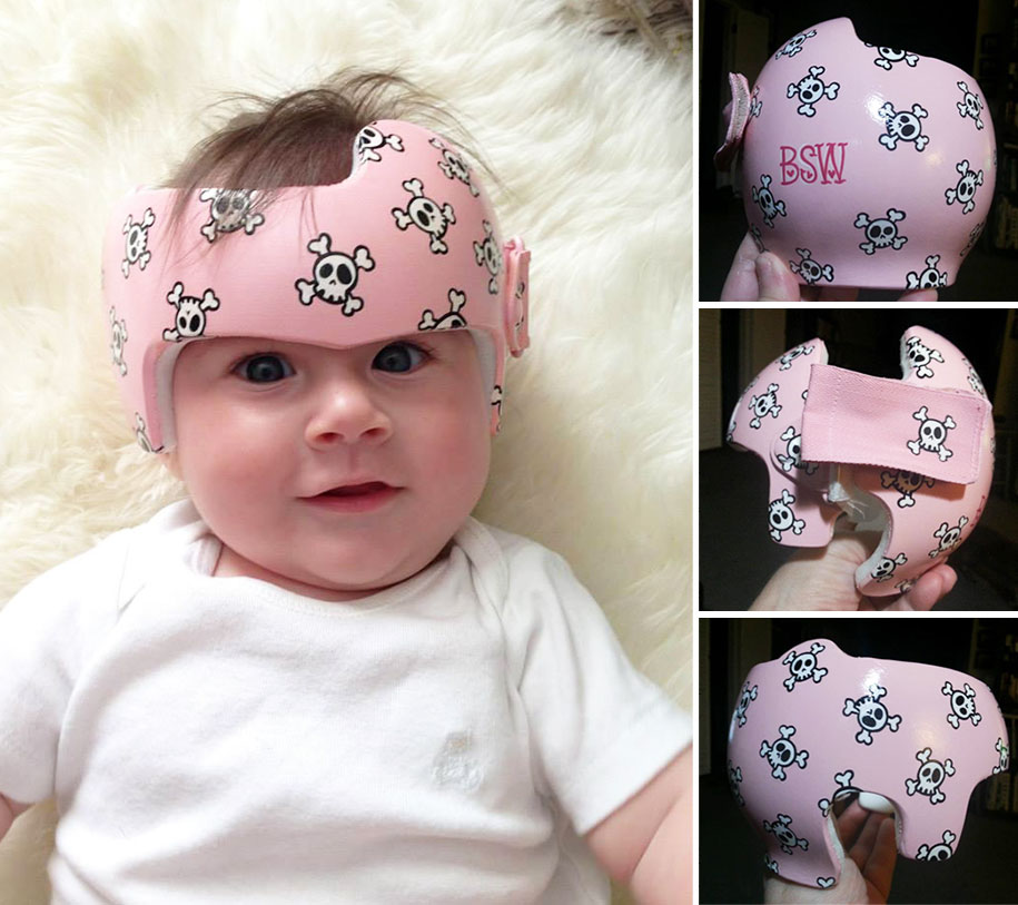 Artist Brings Smiles To Babies By Transforming Their medical Helmets Into Artworks-10