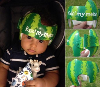 Artist Brings Smiles To Babies By Transforming Their medical Helmets Into Artworks-14