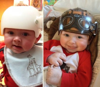 Artist Brings Smiles To Babies By Transforming Their medical Helmets Into Artworks-16