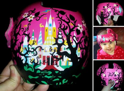 Artist Brings Smiles To Babies By Transforming Their medical Helmets Into Artworks-6