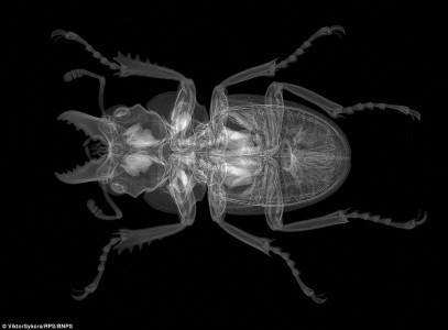 X-ray Scan of Stag Beetle