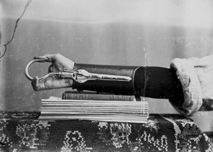 These Ingenious prostheses From 19th century helped 15,000 People Regain Mobility-1