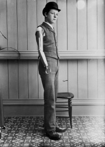These Ingenious prostheses From 19th century helped 15,000 People Regain Mobility-19