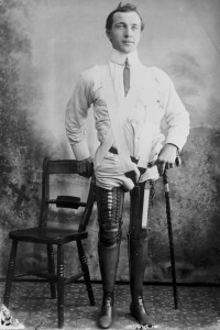 These Ingenious prostheses From 19th century helped 15,000 People Regain Mobility-8